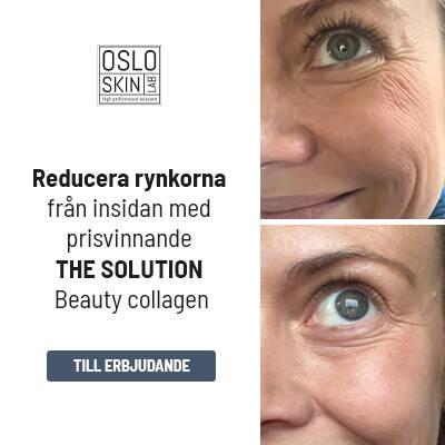 Visar före och efter bild på en person som använt Oslo Skin Lab